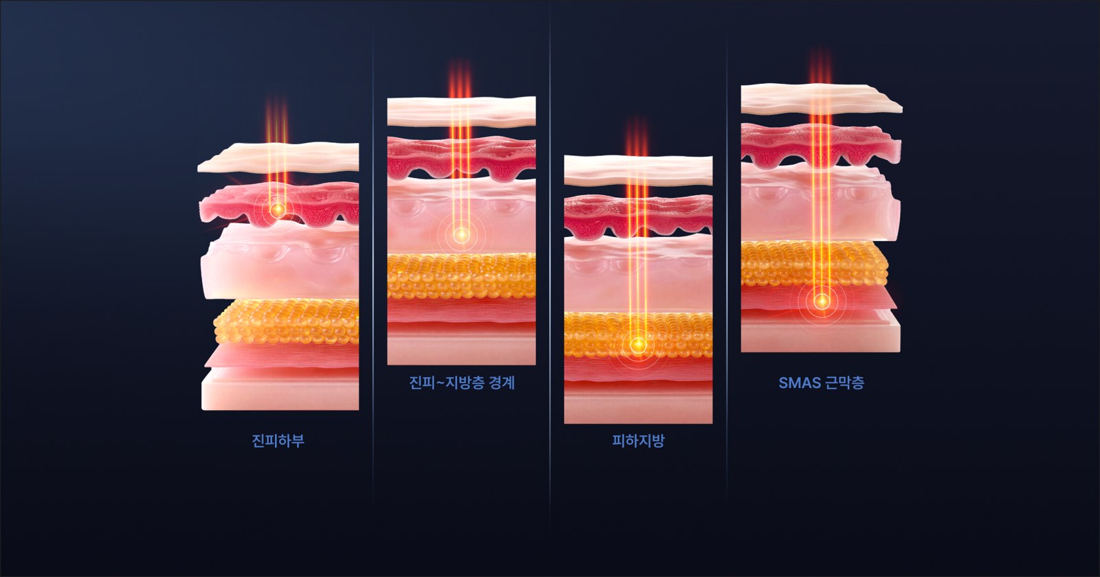 피부층별 에너지 전달