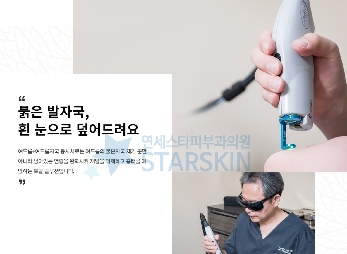 붉은 여드름 자국이 생기기 쉬운 상황을 정리한 안내 이미지