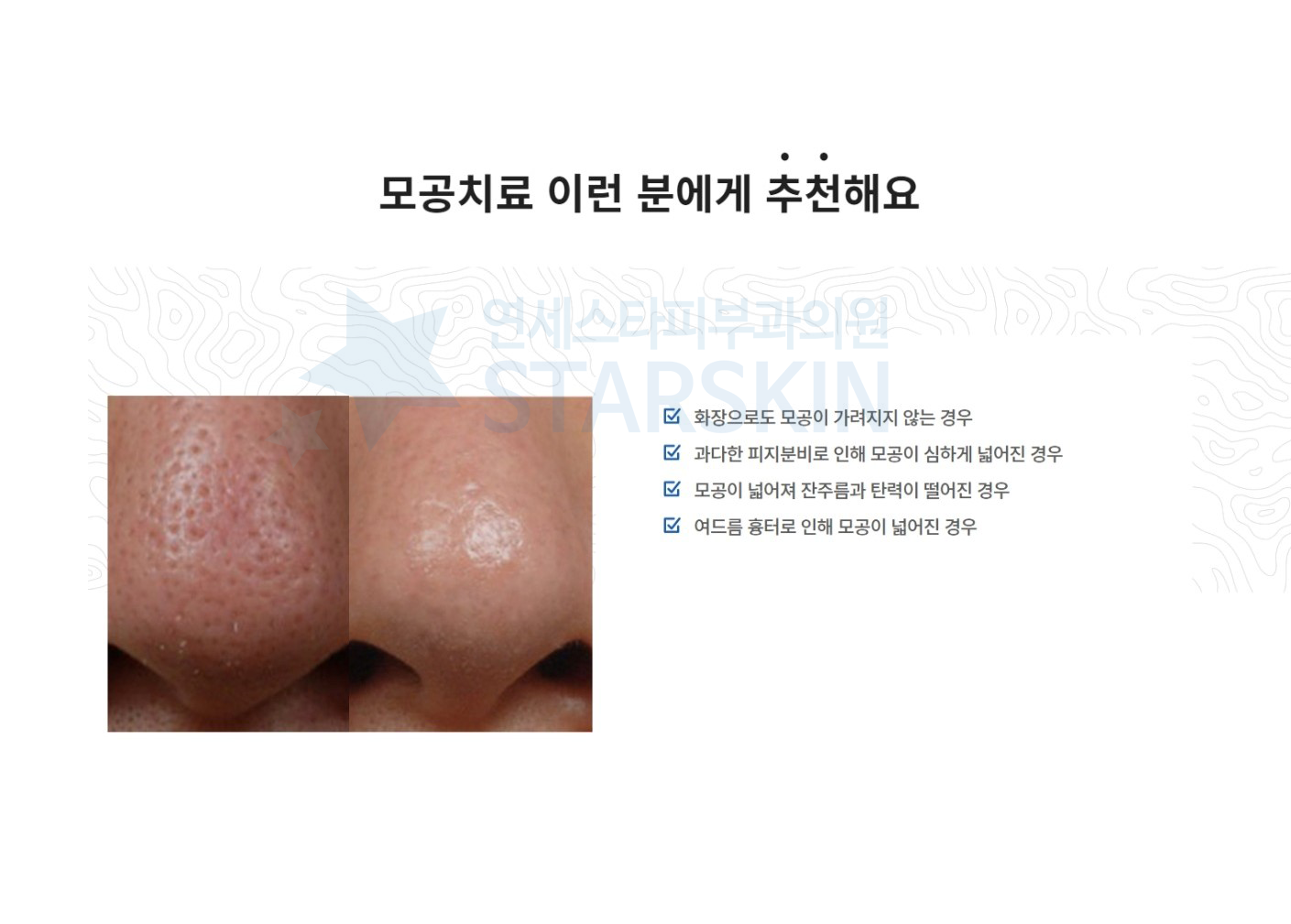 여름철 피지 분비와 모공 변화를 보여주는 이미지